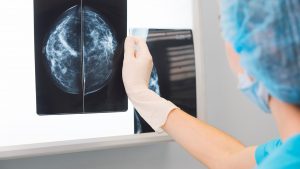 mamografía en Toledo - resultados