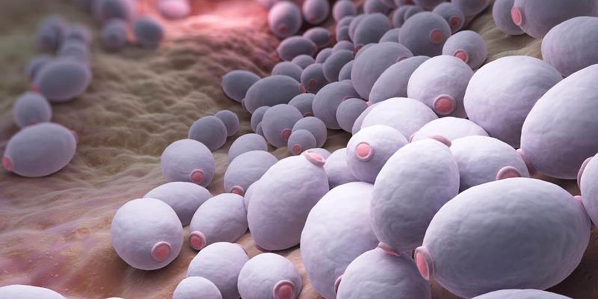 Infección vaginal por hongos