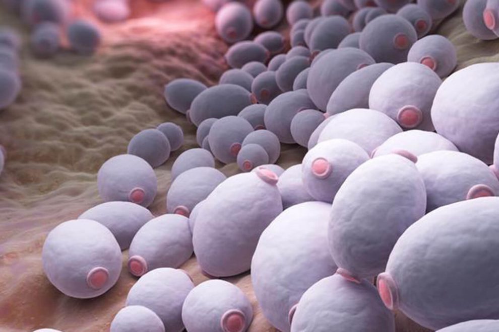 Infección vaginal por hongos