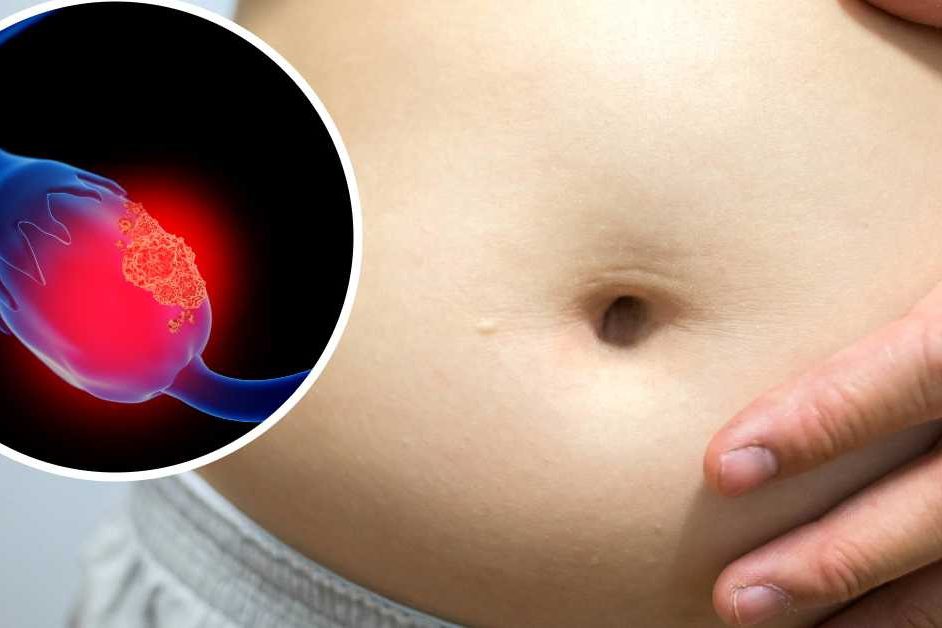 cancer-ovario-enemigo cáncer ovario